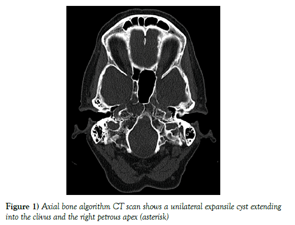 neurology-clinical-neuroscience-bone-algorithm