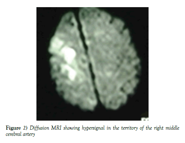 neurology-clinical-neuroscience-cerebral-artery