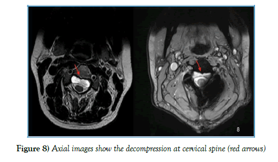 neurology-clinical-neuroscience-cervical-spine