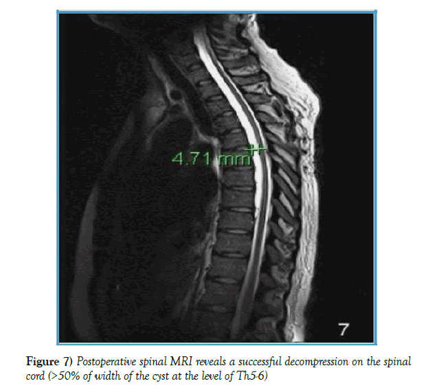 neurology-clinical-neuroscience-decompression