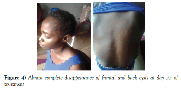 neurology-clinical-neuroscience-disappearance-frontal