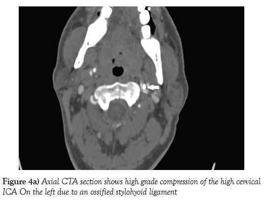 neurology-clinical-neuroscience-high-cervical