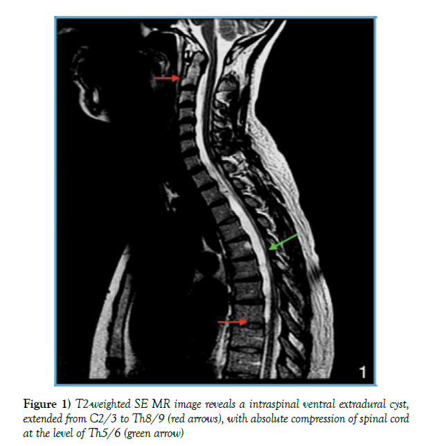 neurology-clinical-neuroscience-intraspinal-ventral