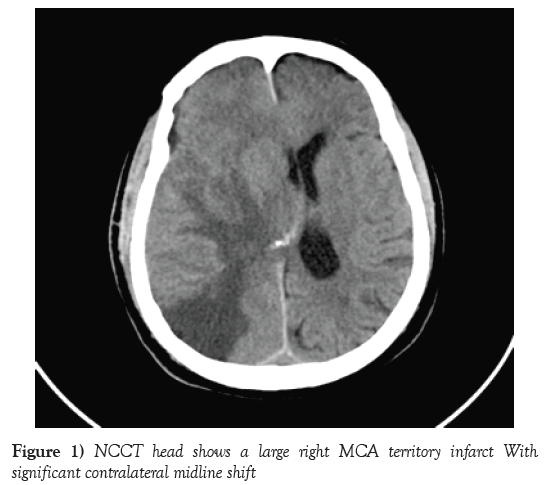 neurology-clinical-neuroscience-large-right