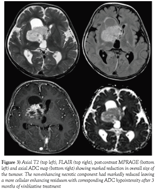 neurology-clinical-neuroscience-marked-reduction