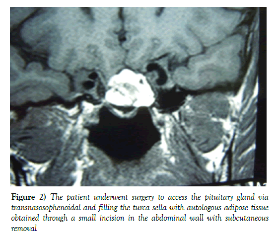 neurology-clinical-neuroscience-pituitary-gland