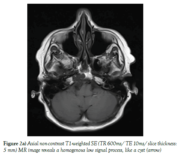 neurology-clinical-neuroscience-reveals-homogenous