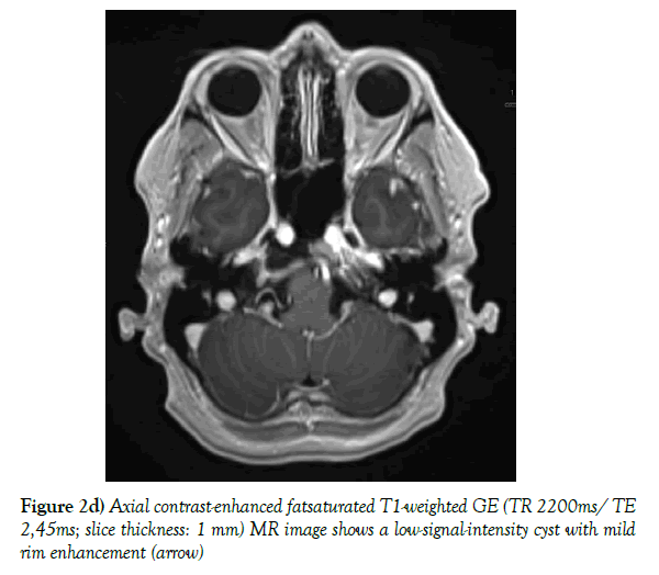 neurology-clinical-neuroscience-signal-intensity