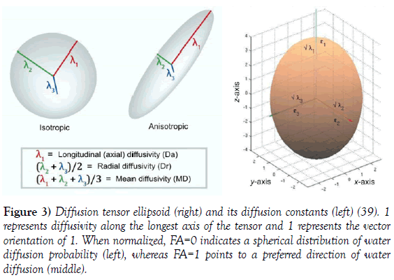 neurology-clinical-neuroscience-tensor-ellipsoid