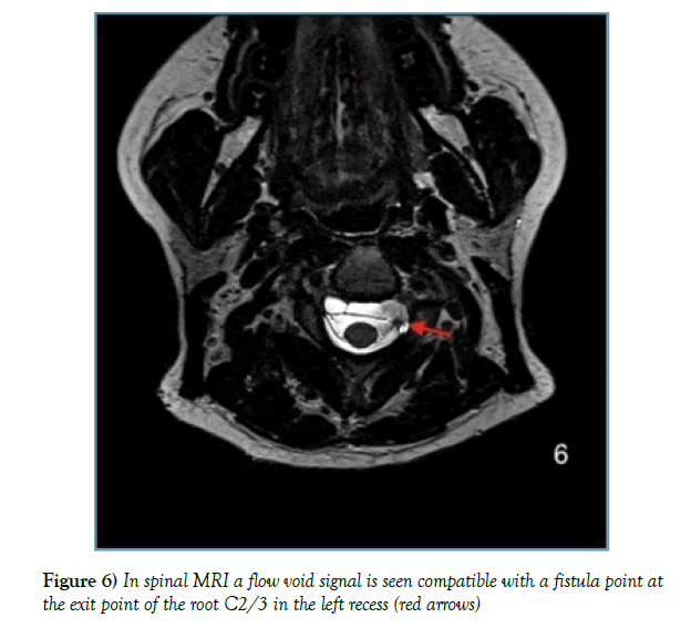 neurology-clinical-neuroscience-void-signal