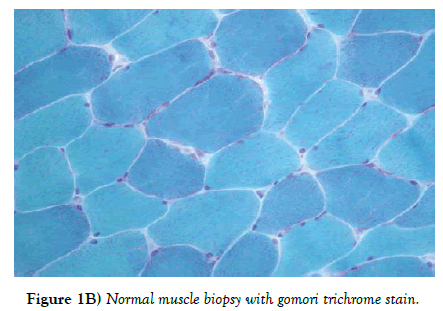 neuropathology-Normal-muscle