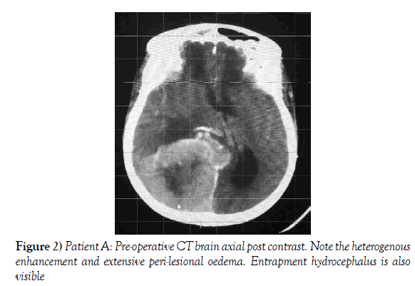 neurosurgery-axial-post-contrast-Note