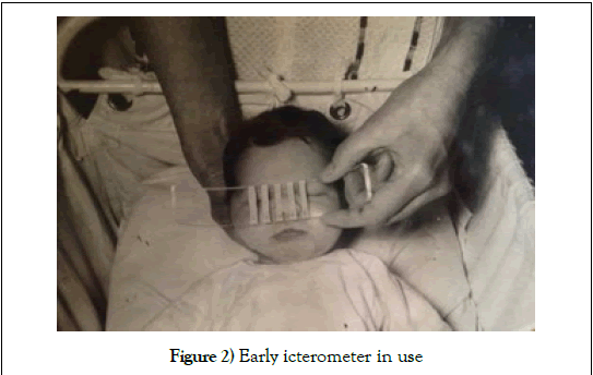 pediatric-health-care-medicine-Early-icterometer