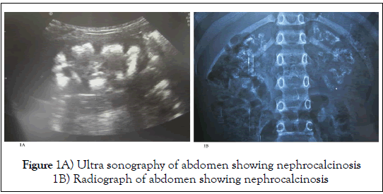 pediatric-health-care-medicine-Ultra-sonography