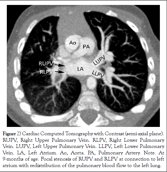 pediatric-health-care-medicine-blood-flow