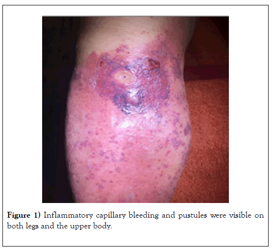 phlebology-lymphology-capillary