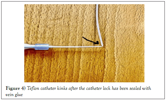 phlebology-lymphology-catheter