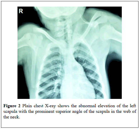 pulsus-journal-surgical-research-Plain-chest