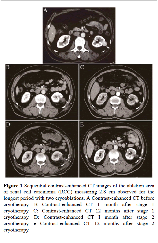 pulsus-journal-surgical-research-Sequential-contrast-enhanced