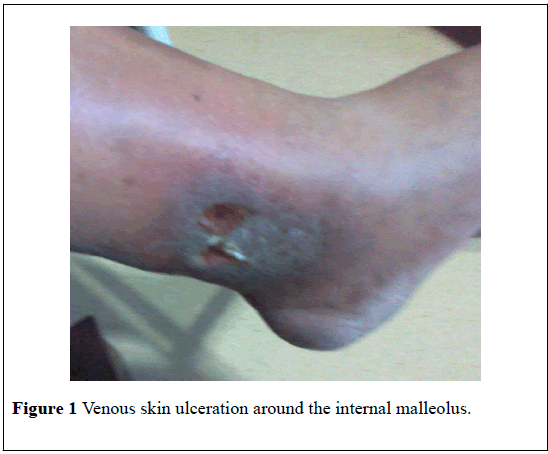 pulsus-journal-surgical-research-Venous-skin