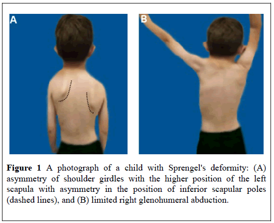 pulsus-journal-surgical-research-glenohumeral-abduction