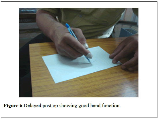 pulsus-journal-surgical-research-hand-function