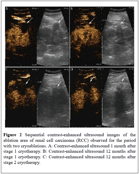 pulsus-journal-surgical-research-ultrasound-images