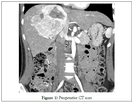 surgery-case-report-CT-scan