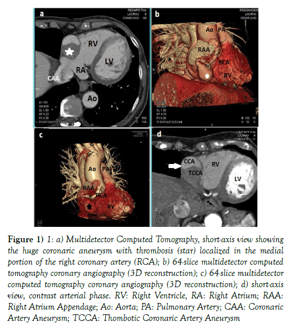 surgery-case-report-Computed-Tomography