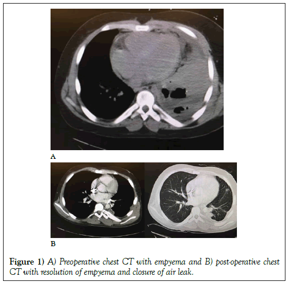 surgery-case-report-Preoperative