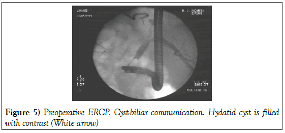 surgery-case-report-Preoperative