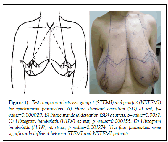 surgery-case-report-Test-comparison