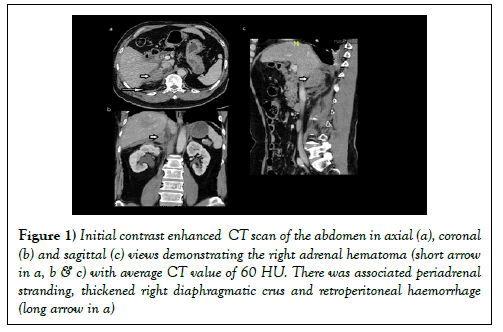 surgery-case-report-abdomen