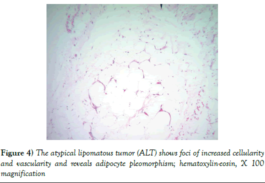 surgery-case-report-cellularity-vascularity