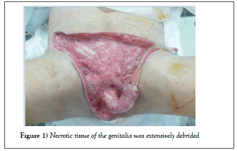 surgery-case-report-genitalia
