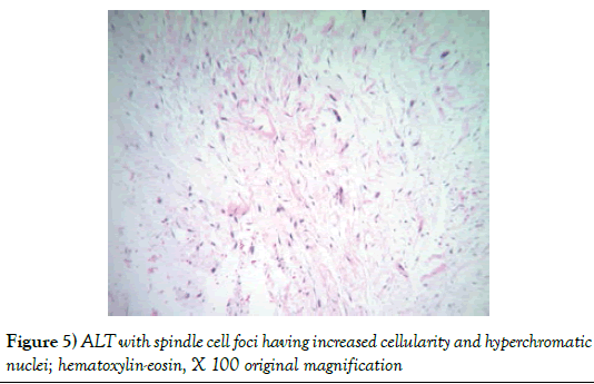 surgery-case-report-hyperchromatic-nuclei