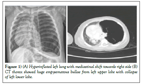 surgery-case-report-hyperinflated