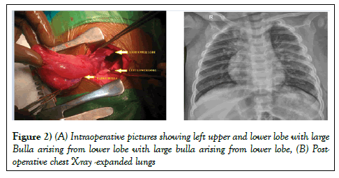 surgery-case-report-intraoperative