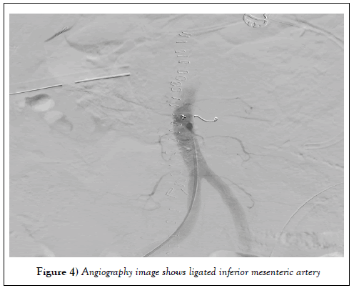 surgery-case-report-ligated-inferior