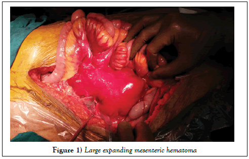 surgery-case-report-mesenteric