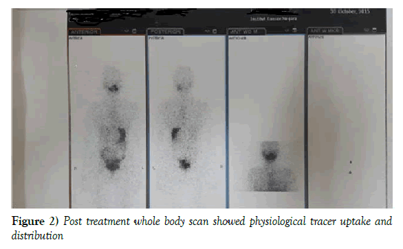 surgery-case-report-physiological-tracer