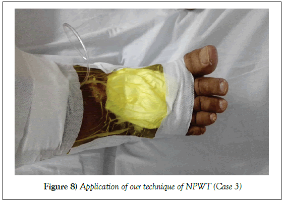 surgery-case-report-technique