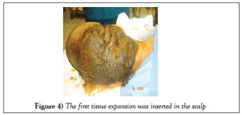 surgery-case-report-tissue