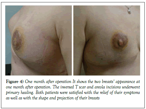 surgery-case-report-underwent-primary