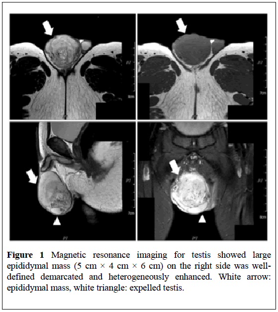 surgical-research-Magnetic-resonance