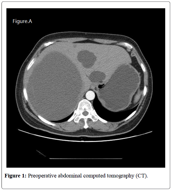 surgical-research-computed-tomography