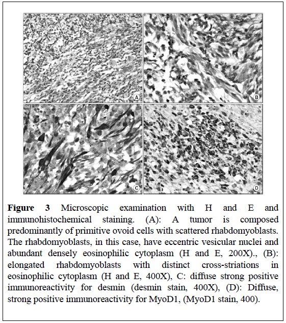 surgical-research-immunohistochemical-staining
