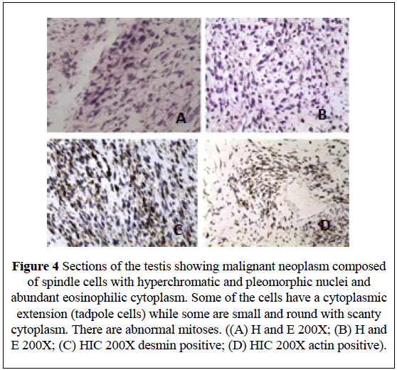 surgical-research-pleomorphic-nuclei