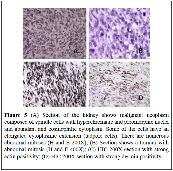 surgical-research-spindle-cells