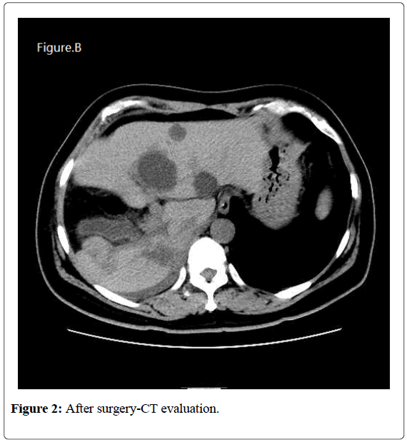 surgical-research-surgery-CT-evaluation